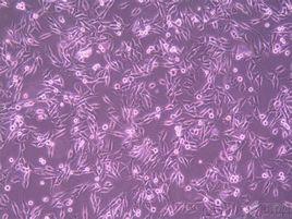 無限細胞系 無限細胞系