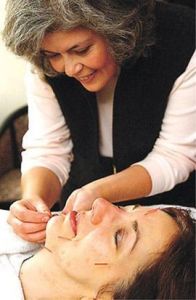 針灸美容 針灸美容