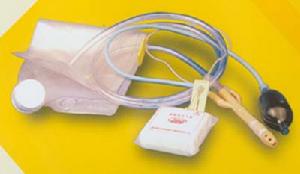 小兒先天性巨結腸