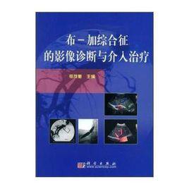 布加綜合徵的影像診斷與介入治療 布加綜合徵的影像診斷與介入治療