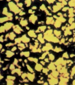 超米粒組織 超米粒組織