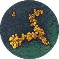 金黃色葡萄球菌腦膜炎