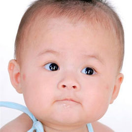 隱形唇裂 隱形唇裂