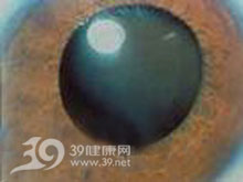 晶體異位和脫位