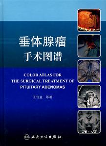 垂體腺瘤手術圖譜 垂體腺瘤手術圖譜