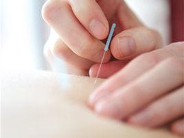 針刺補瀉 針刺補瀉