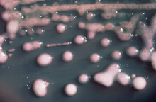 肺炎克雷伯氏菌，第一個被發現攜帶NDM-1酶的細菌