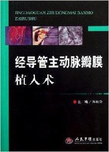 經導管主動脈瓣膜植入術 經導管主動脈瓣膜植入術