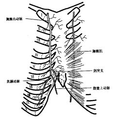 胸廓出口綜合症