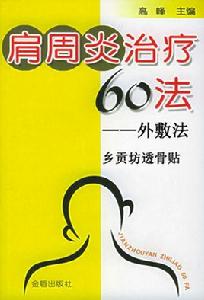 肩周炎治療60法