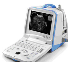 中國B超網 中國B超網