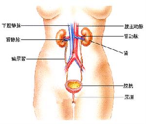 膿尿