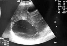 速發性毒作用 速發性毒作用