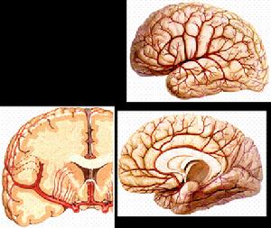 顱內肉芽腫性動脈炎