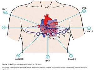 心電圖導聯 心電圖導聯
