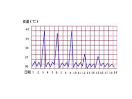 發熱熱型 發熱熱型