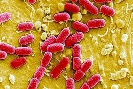 大腸桿菌 大腸桿菌