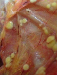 結節[醫療用語]