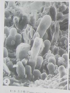 普雷沃菌屬 普雷沃菌屬