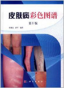 皮膚病彩色圖譜