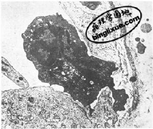 圖4 中性白細胞游出