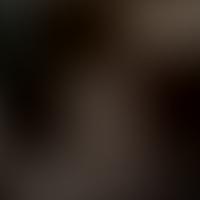 IC 2530 RASS 彩色圖