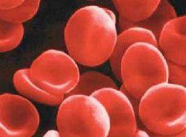 紅細胞體積增大 紅細胞體積增大