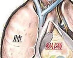 縱膈腫瘤 縱膈腫瘤