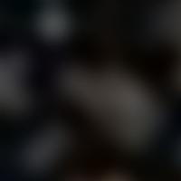 HR 881 RASS 彩色圖