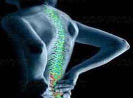 脊柱退變 脊柱退變