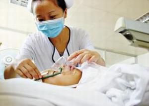 笑性癲癇 笑性癲癇