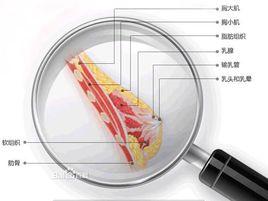 乳暈脫毛手術 乳暈脫毛手術