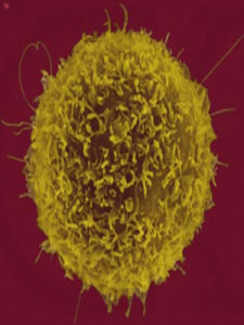 淋巴細胞 淋巴細胞