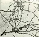 吲哚陰性 吲哚陰性