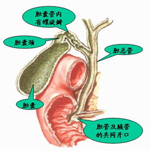 先天性肝內膽管囊狀擴張症