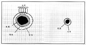 《黃斑裂孔的手術治療》