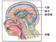 蛛網膜下腔出血