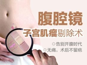 子宮肌瘤剔除術 子宮肌瘤剔除術