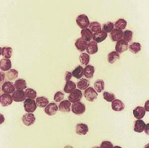 隱孢子蟲病 隱孢子蟲病