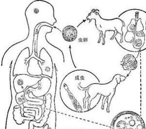 腦包蟲病 腦包蟲病