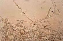 小被孢霉 小被孢霉