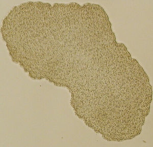 扁盤動物門 扁盤動物門