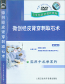 《微創經皮腎穿刺取石術》