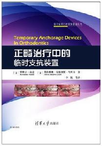 正畸治療中的臨時支抗裝置 正畸治療中的臨時支抗裝置
