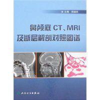 鼻顱底CT,MRI及斷層解剖對照圖譜