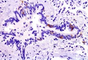 樹枝狀細胞 樹枝狀細胞