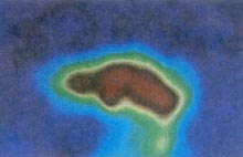 放射性同位素 放射性同位素