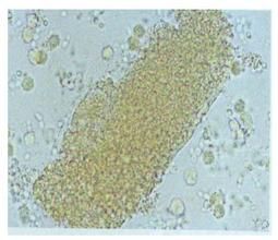 尿液有形成分 尿液有形成分