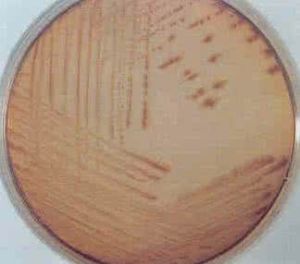 鹽胞菌屬 鹽胞菌屬