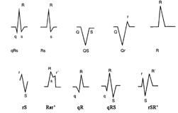 竇性心率 竇性心率